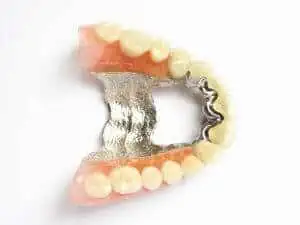 Zahnprothese mit Chrom vs flexible Zahnprothese aus Nylon