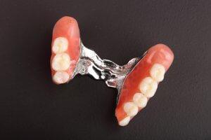 metal partial denture for back teeth