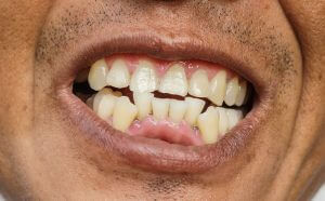 orthodontics