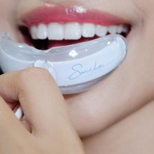 cosmetic teeth whitening kit