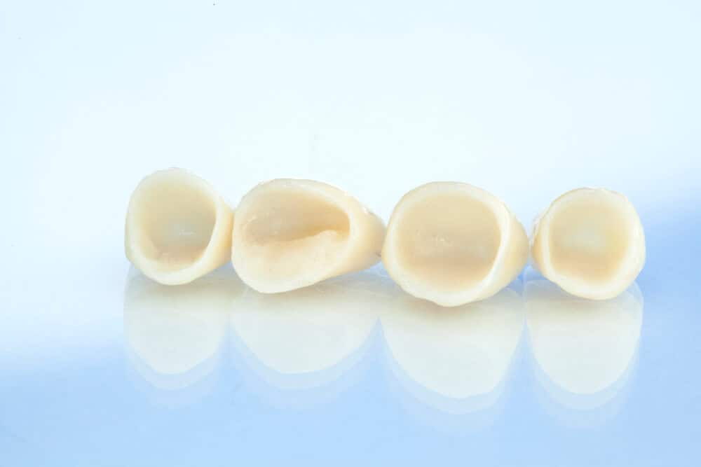 Private Dental Charges (UK) Prices, Treatments and Affordability