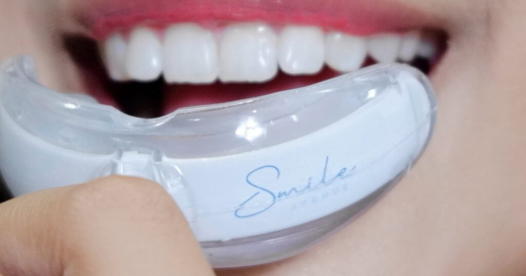 Teeth Whitening