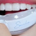 smile avenue teeth whitening kit