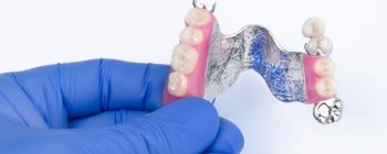 dentures chrome