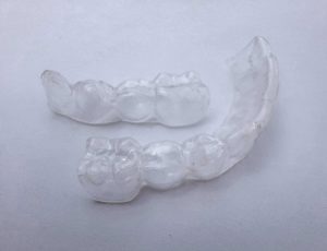 when to get a replacement retainer