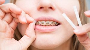 orthodontics