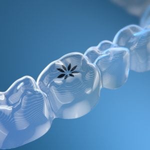 teeth straightening for teens with invisalign