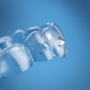 tooth pain invisalign