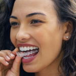 31747Teeth Straightening App: What Would You Look Like With Straight Teeth?