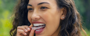 can you switch from braces to Invisalign