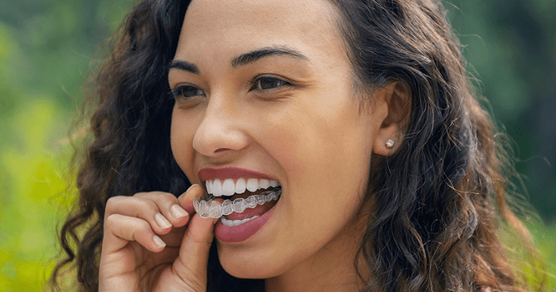 can you switch from braces to Invisalign