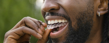 invisalign express aligners