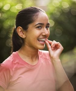 removable aligner braces for teens
