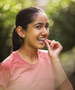 woman inserting Invisalign aligners wondering how long it will take