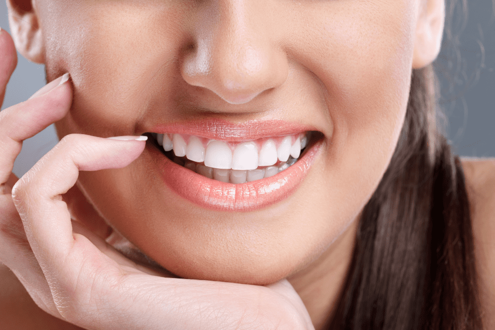 Can You Whiten Veneers? Teeth Whitening Tips for Veneers Tips