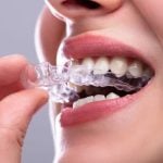 35854How to Clean Retainers: The Best Products & Steps for Proper Care