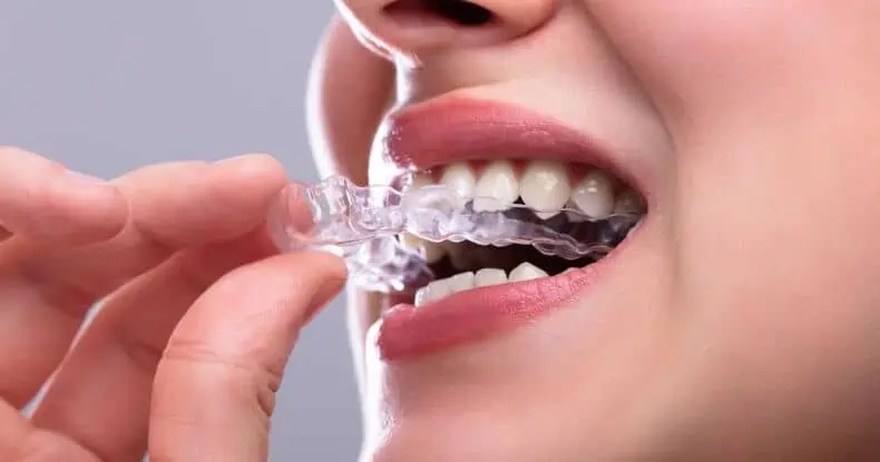 35920Grinding Teeth With Invisalign Aligners: What Does It Mean and Can You Still Get Treatment?