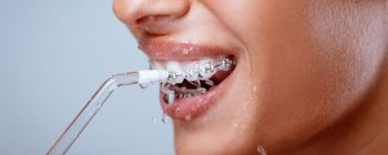 best waterpik for braces