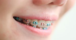 NHS braces colours