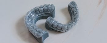 mouth guard for teeth gringing