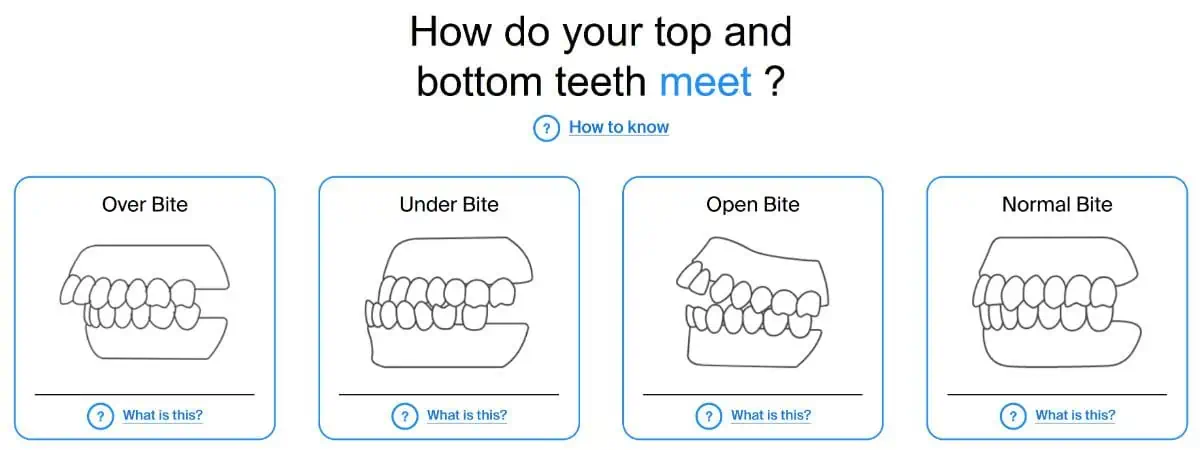 fast braces journey