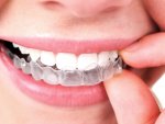 47446Mejor blanqueador dental: precios, opiniones y tratamientos