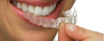 Invisalign precio