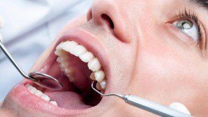 Revision odontologica