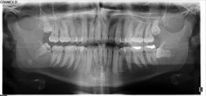 Este u otro tipo de radiografías según tu problema seguramente serán las que solicite tu especialista tratante - estructuras anatómicas