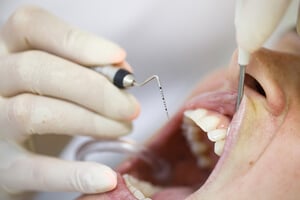 mantenimiento periodontal precio  