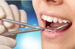 periodo de carencia axa seguro dental