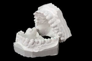 dentadura postiza molde