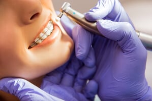 cobertura ortodoncia dkv seguro dental