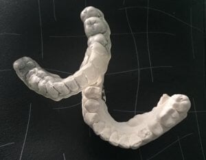 arcada, forma de arco que toman los dientes en su posición en los maxilares