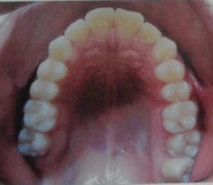 Vista oclusal de los dientes y su forma