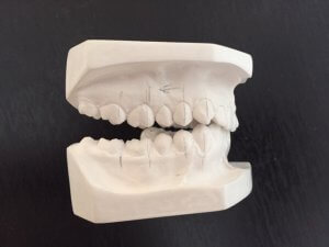 Los molares son los dientes encargados directamente de la masticación