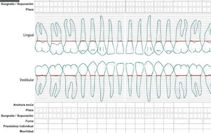 Periodontograma