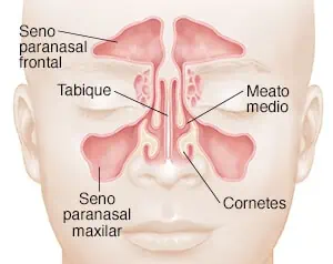 elevación de Seno maxilar