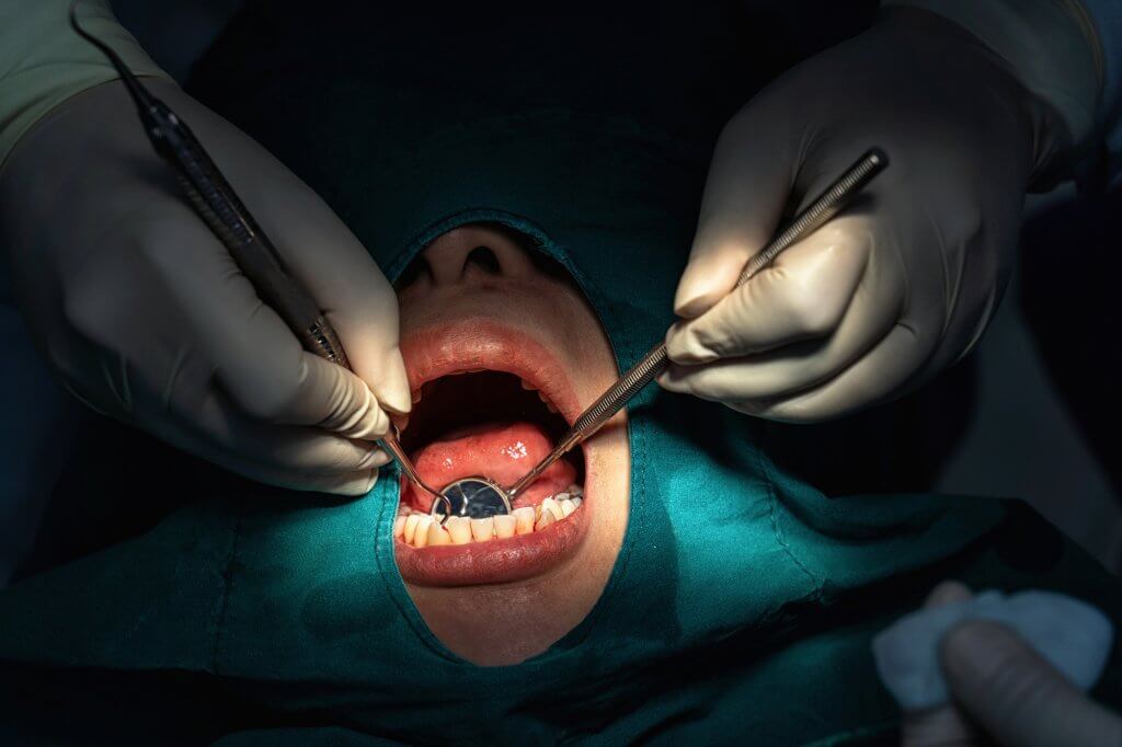 cirugía torus mandibular