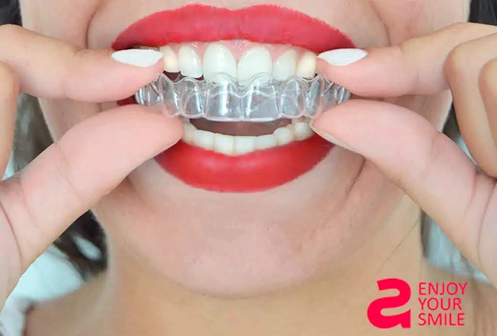 Alternativas a Invisalign made in Spain