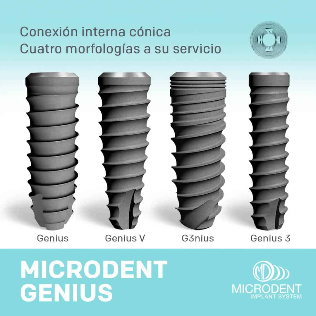 ¿Cuáles son las mejores marcas de implantes dentales?