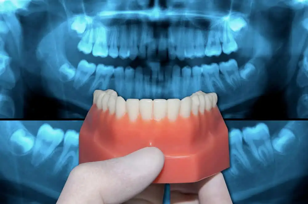 spark ortodonzia