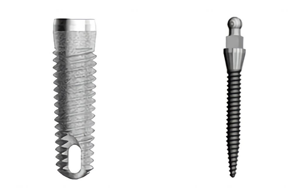 alternativas a los implantes dentales