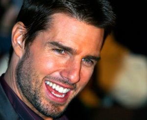 Famosos ortodoncia invisible - Tom Cruise
