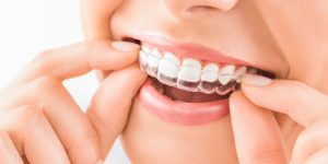 invisalign comprehensive precio