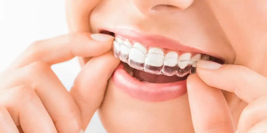 seguro dental invisalign