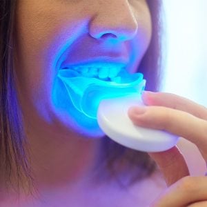 aparato para blanquear los dientes