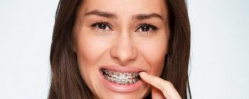 duelen las encias inflamadas con brackets