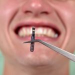 27494Irrigador bucal: los mejores irrigadores dentales 2022