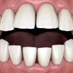 27068Lengua saburral y otras causas de la lengua blanca: síntomas, tratamientos y remedios caseros